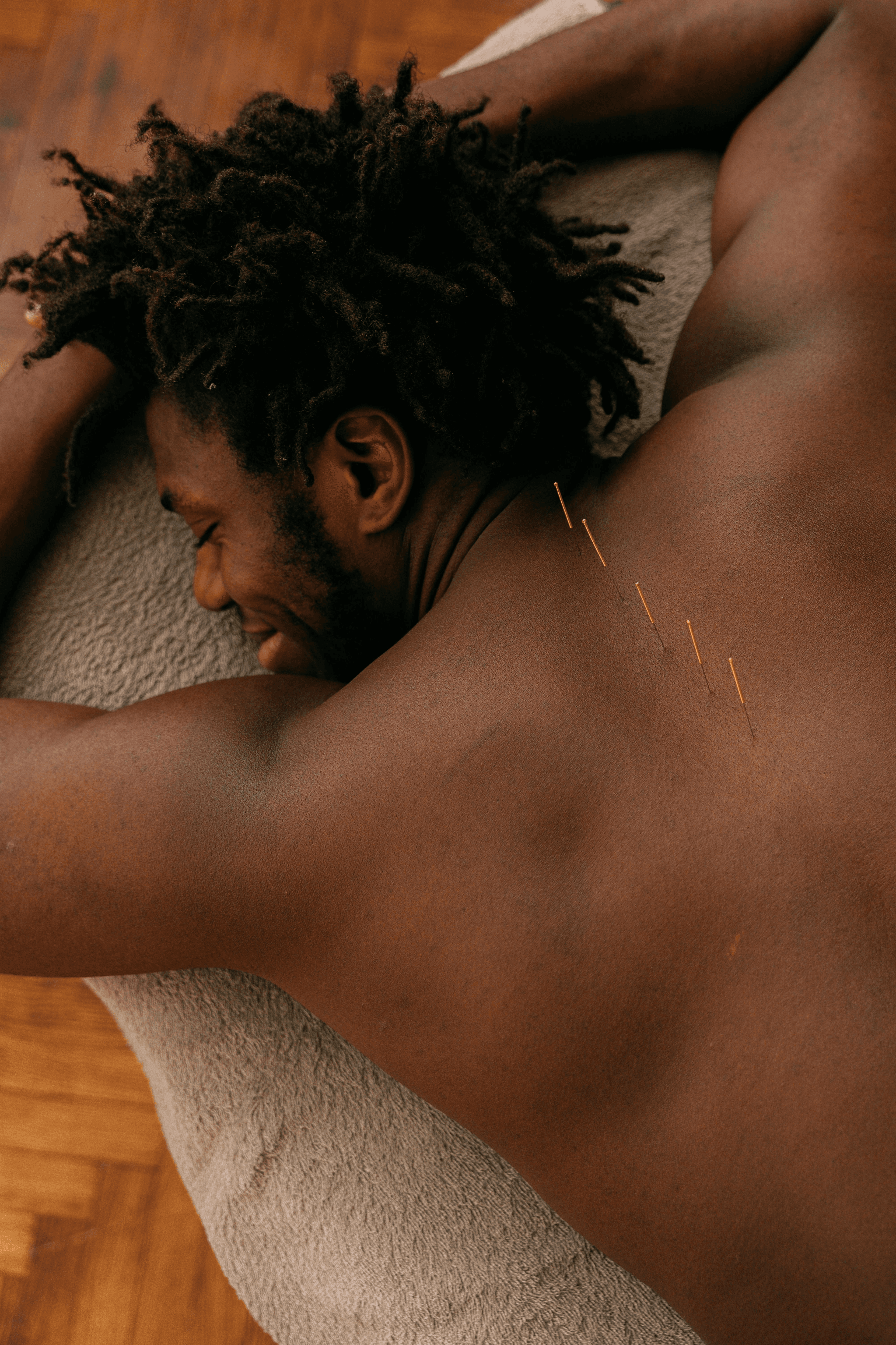 Man receiving acupuncture treatment for pain relief